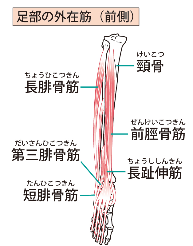 シンスプリントとは